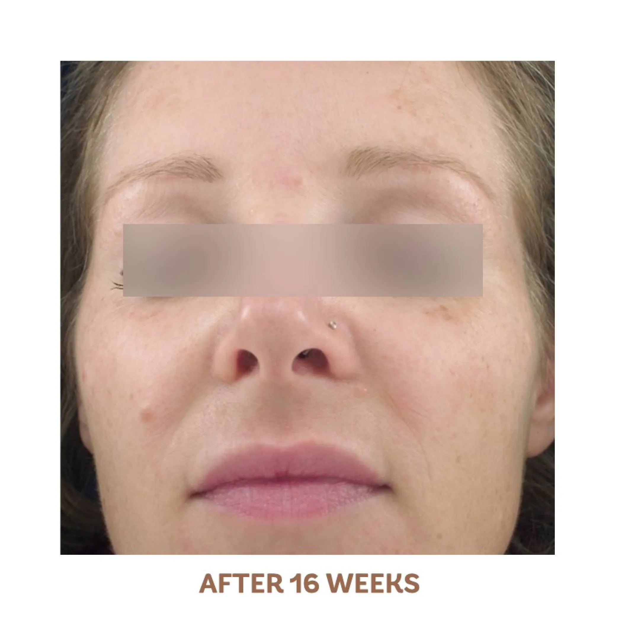 Radiance Serum